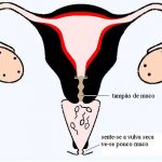 Padrão básico de infertilidade- PBI